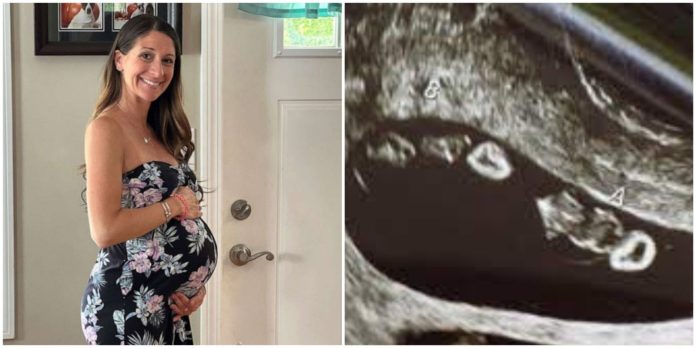 Mama doživjela šok na ultrazvuku