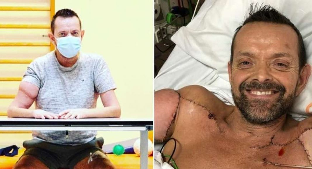 Nakon strujnog udara amputirane su mu obje ruke, a sada ponovno može zagrliti unuke