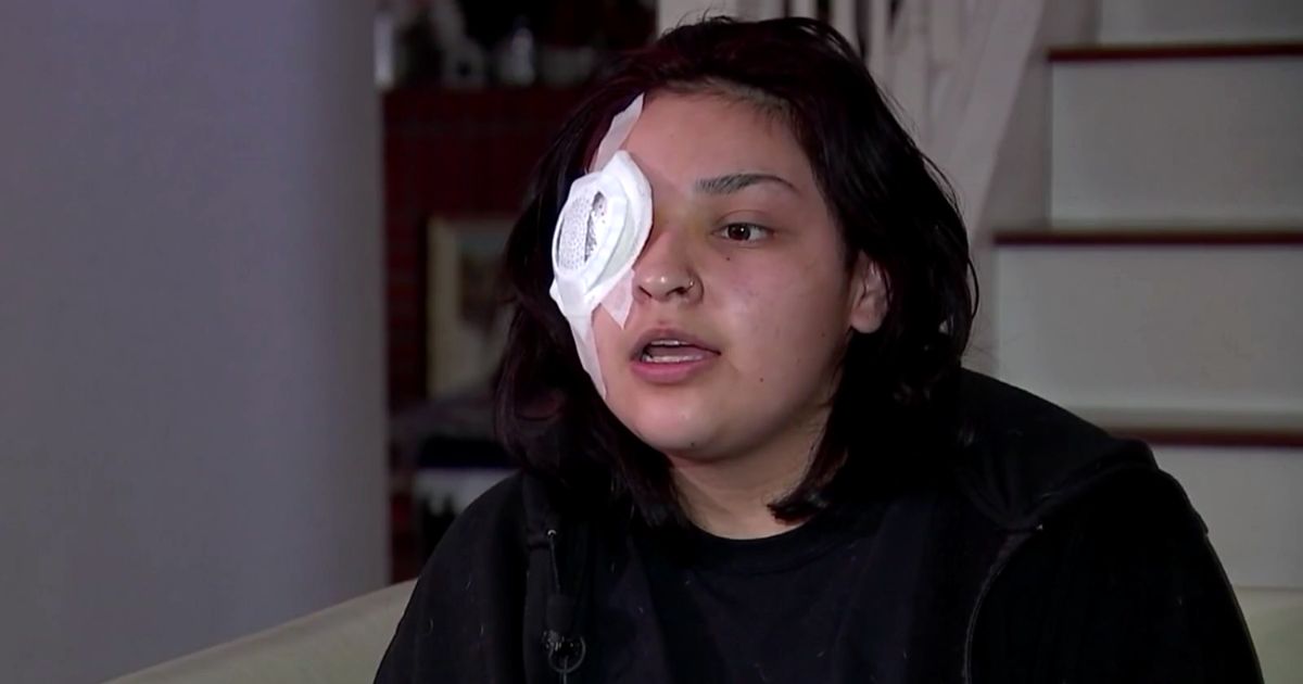 Djevojka (19) izgubila oko u brutalnom napadu dok je branila dječaka s posebnim potrebama
