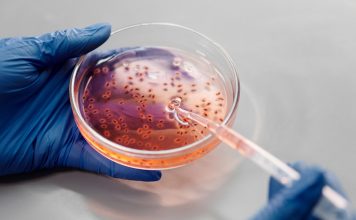 Marburški virus