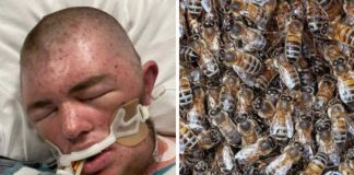 Mladić slučajno posjekao košnicu pa ga je izbolo 20.000 pčela