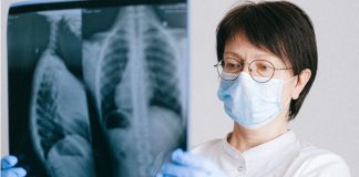Zašto sve više nepušača obolijeva od raka pluća