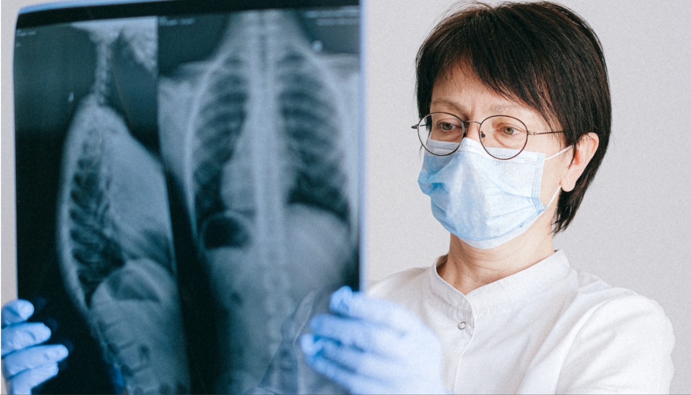Zašto sve više nepušača obolijeva od raka pluća