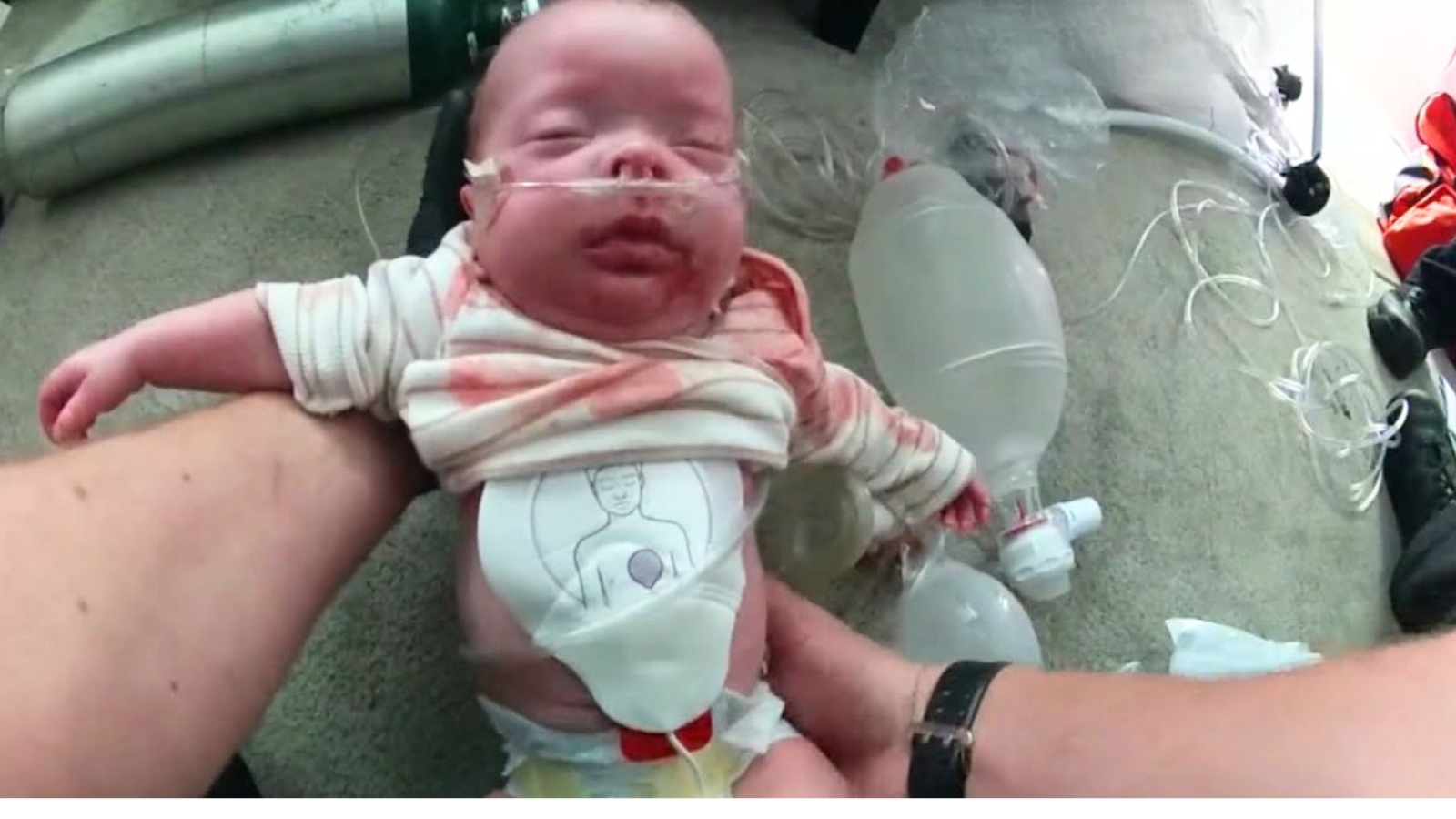 Beba je prestala disati i nije imala puls