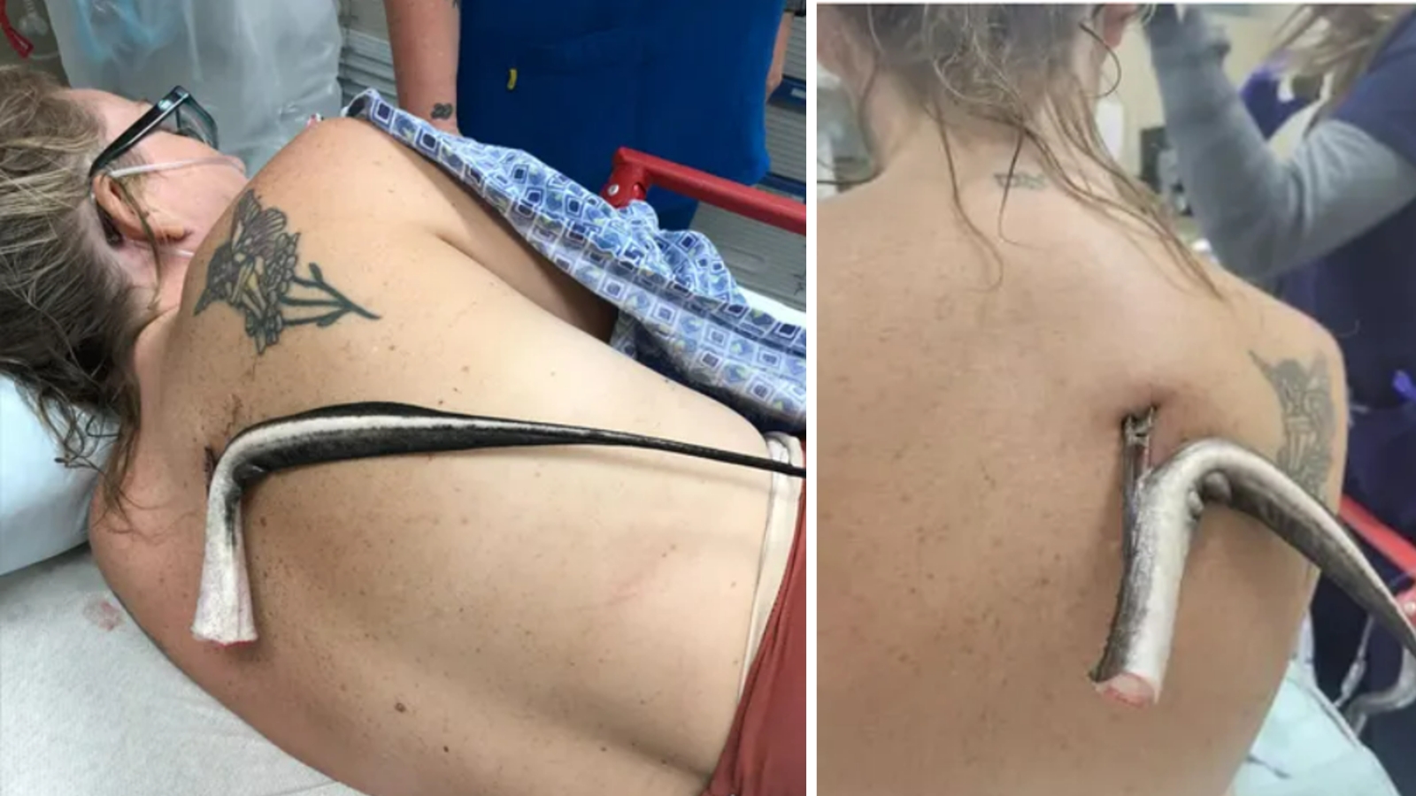 Žena je uživala sa suprugom na plaži kada je osjetila nešto na leđima
