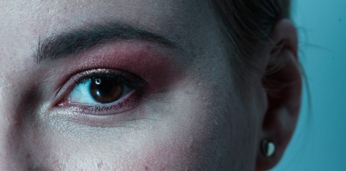Žena umrla zbog bolesti od koje krvare oči