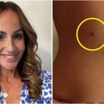 Mama oboljela od melanoma ima važno upozorenje za sve koji se "igraju s vatrom"