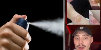 Tinejdžer preminuo zbog TikTok izazova dezodorans u spreju