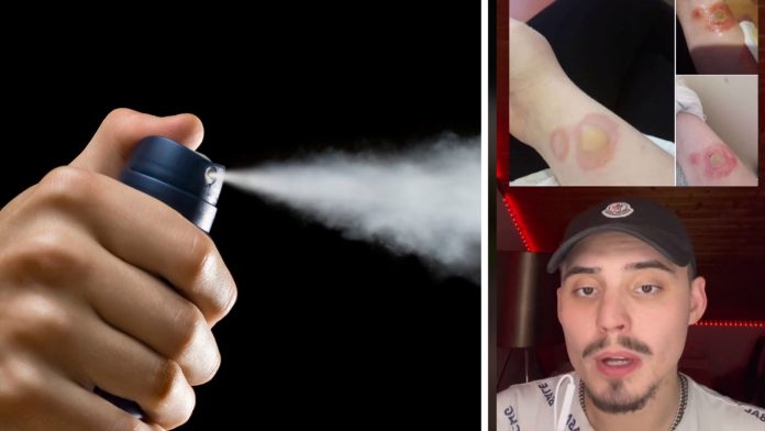 Tinejdžer preminuo zbog TikTok izazova dezodorans u spreju