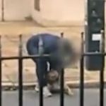 Pas ugrizao dijete za nogu