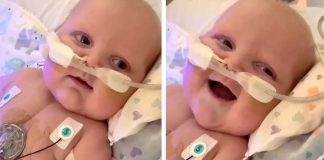 Beba se prvi put smije nakon dvije operacije srca i moždanog udara