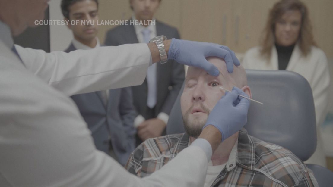 Čudo medicine: Kirurzi su prvi put pacijentu presadili cijelo oko
