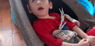 Trogodišnji dječak Noa je slijep i nepokretan: Treba našu pomoć