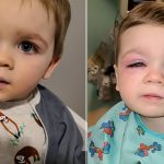 Mama ima poruku za roditelje nakon što je njezin sin skoro oslijepio od popularne igračke za kupanje