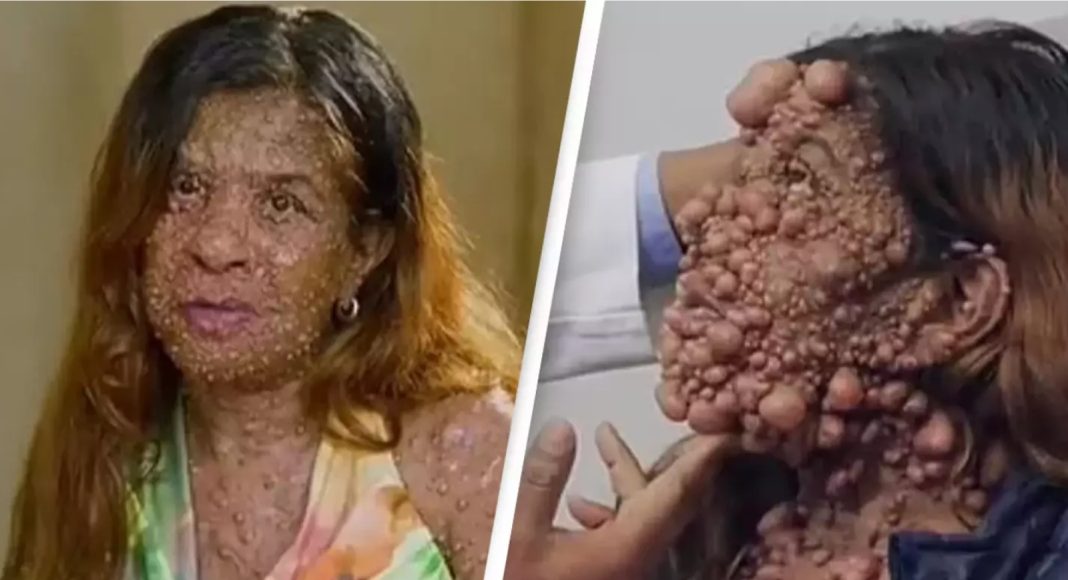 Žena s teškom bolešću konačno može ponovno vidjeti svoje lice