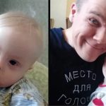 Otac sam odgaja dječaka s Downovim sindromom