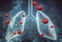 Alarmantan porast raka pluća kod nepušača
