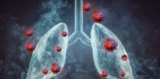 Alarmantan porast raka pluća kod nepušača