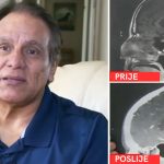 Tumor na mozgu nestao