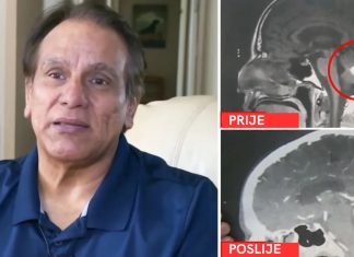 Tumor na mozgu nestao