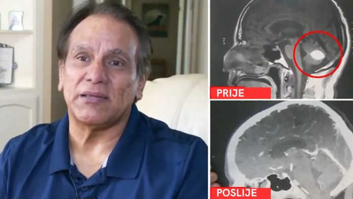 Tumor na mozgu nestao