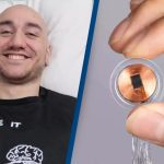 Neuralink Elona Muska je podijelio novost o prvom čovjeku koji ima moždani implantat