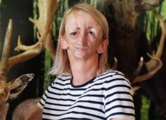 Ani iz Bošnjaka svi su se rugali i ismijavali je zbog lica: "Ovo je moje lice, ne sramim ga se"