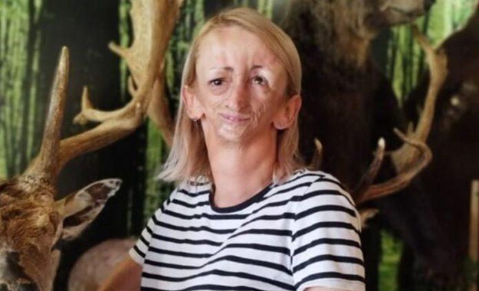 Ani iz Bošnjaka svi su se rugali i ismijavali je zbog lica: 