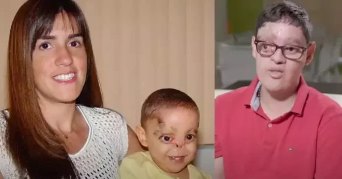 Liječnici su mislili da neće preživjeti, no vjerni roditelji su odbili odustati od bebe bez nosa