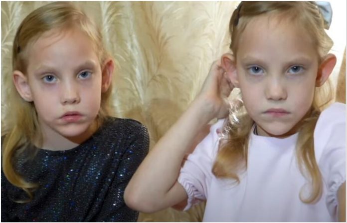 Otac pobjegao kada je čuo za blizanke, priča o njima je obišla svijet