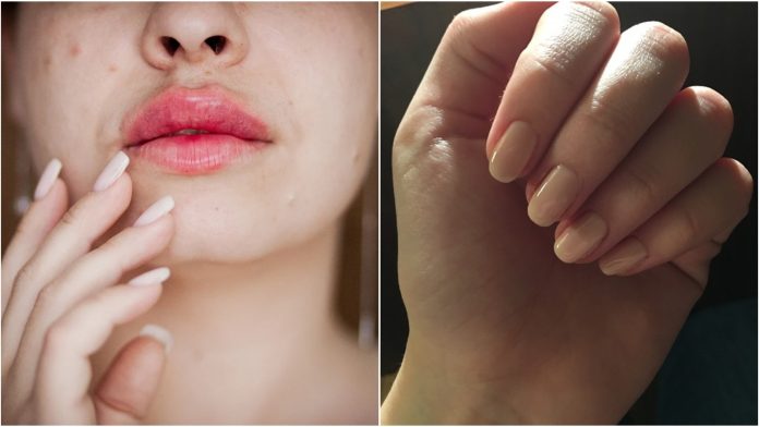Liječnica otkrila zanemarene znakove smrtonosnog raka