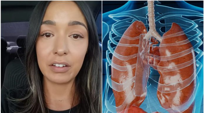 Žena s dijagnozom raka u dobi od 34 godine dijeli pet simptoma koje je ignorirala
