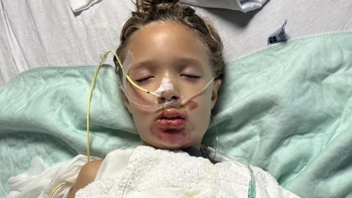 Roditelji izdali upozorenje nakon što je djevojčica (7) završila u komi