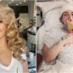 Žena tumor na mozgu