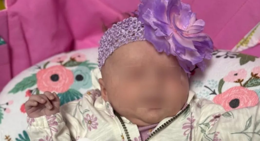 Beba Lucy rođena bez očiju