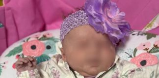 Beba Lucy rođena bez očiju