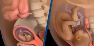 Simulacija rasta bebe