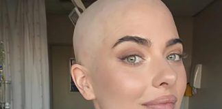 Mislila je da je naduta, a dijagnoza ju je šokirala