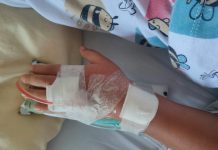 Dječak (11) umro nakon plivanja u bazenu: U nos mu je ušla rijetka ameba