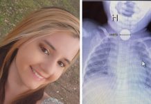 Dječak je počeo vrištati, a liječnici su otkrili šokantnu istinu
