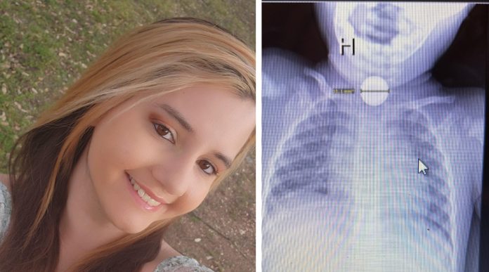 Dječak je počeo vrištati, a liječnici su otkrili šokantnu istinu