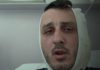 Izraelac tvrdi da mu je muškarac u Grčkoj odgrizao dio uha vičući 'Ja sam Hamas'