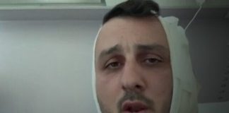 Izraelac tvrdi da mu je muškarac u Grčkoj odgrizao dio uha vičući 'Ja sam Hamas'