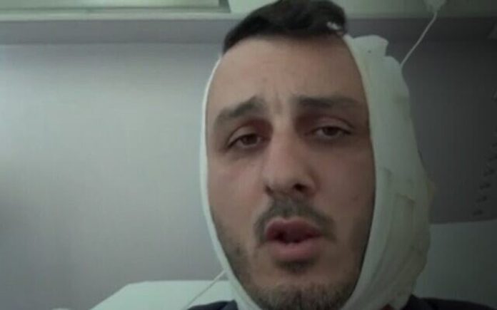 Izraelac tvrdi da mu je muškarac u Grčkoj odgrizao dio uha vičući 'Ja sam Hamas'