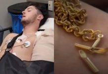 Mladić preživio pucanj nakon što je metak pogodio križ na ogrlici: "Bog je razlog zašto sam živ"