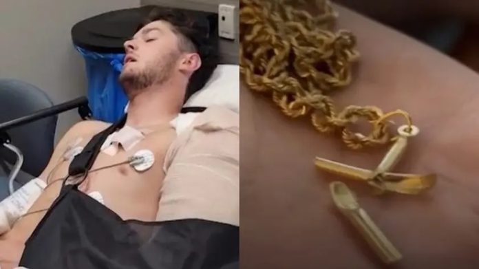 Mladić preživio pucanj nakon što je metak pogodio križ na ogrlici: 