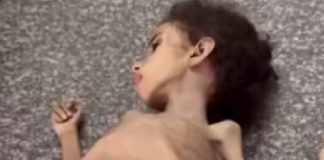 Šokantan prizor u Gazi: Još jedna djevojčica (4) umrla od gladi