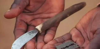 39 dječaka preminulo nakon obreda obrezivanja