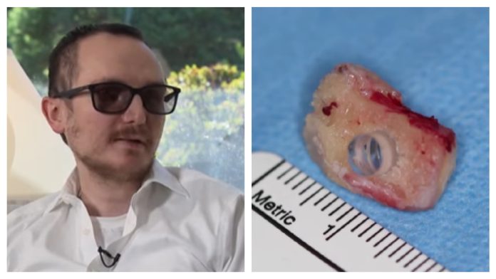 Doktori mu vratili vid nakon 20 godina: 'U oko su mi ugradili zub'