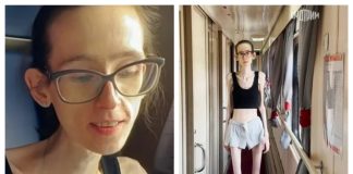 Ova djevojka je željela biti mršava da bi postala popularna u školi: Sada ima 29 kilograma na 176 cm visine